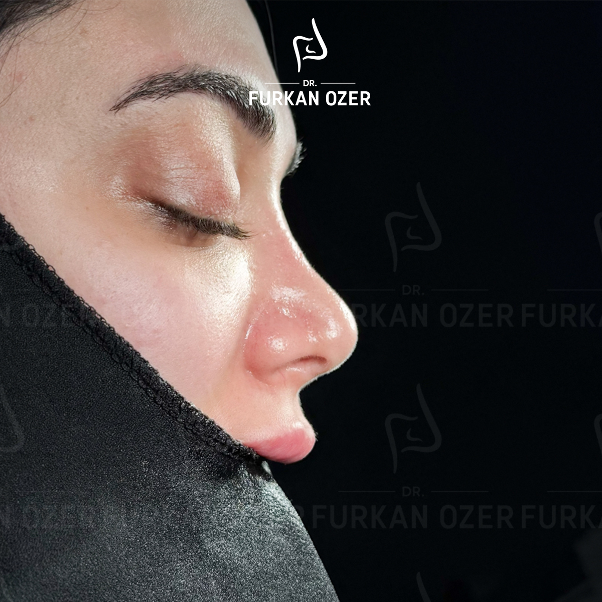 Estetik cerrahi öncesi - Dr. Furkan Özer