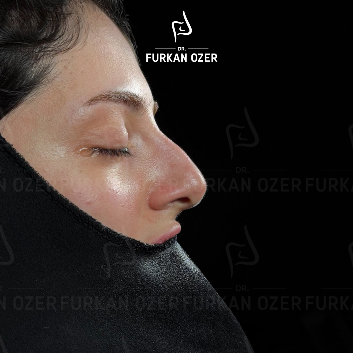 Estetik cerrahi öncesi - Dr. Furkan Özer