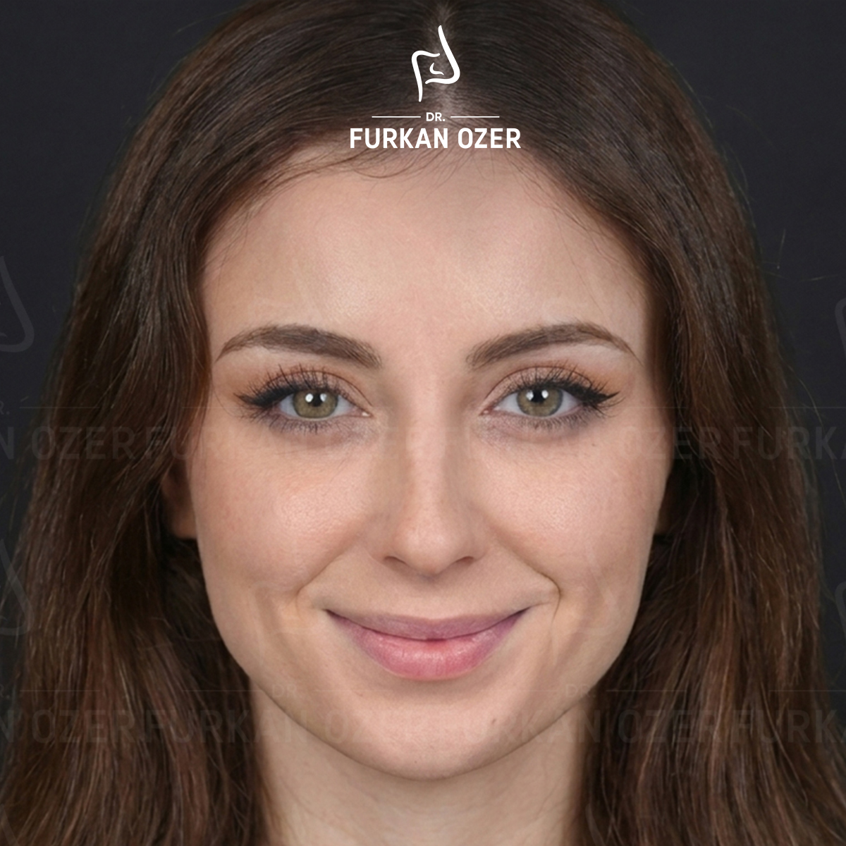 Estetik cerrahi öncesi - Dr. Furkan Özer