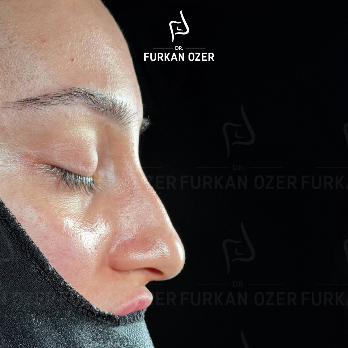 Estetik cerrahi öncesi - Dr. Furkan Özer