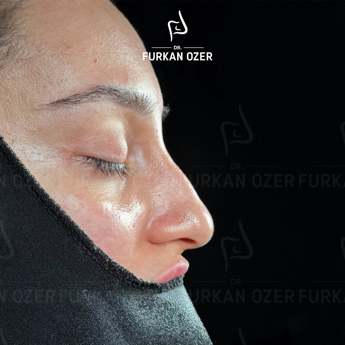 Estetik cerrahi öncesi - Dr. Furkan Özer